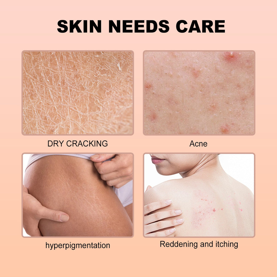 Cinnamon Bun Body Oil for Dry, Dull Skin