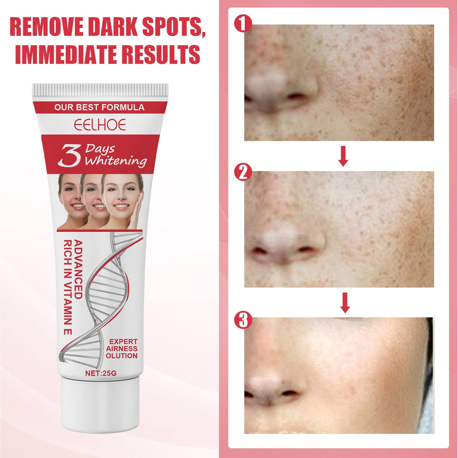 Vitamin E Facial Moisturizer for Dark Spots & Dull Skin