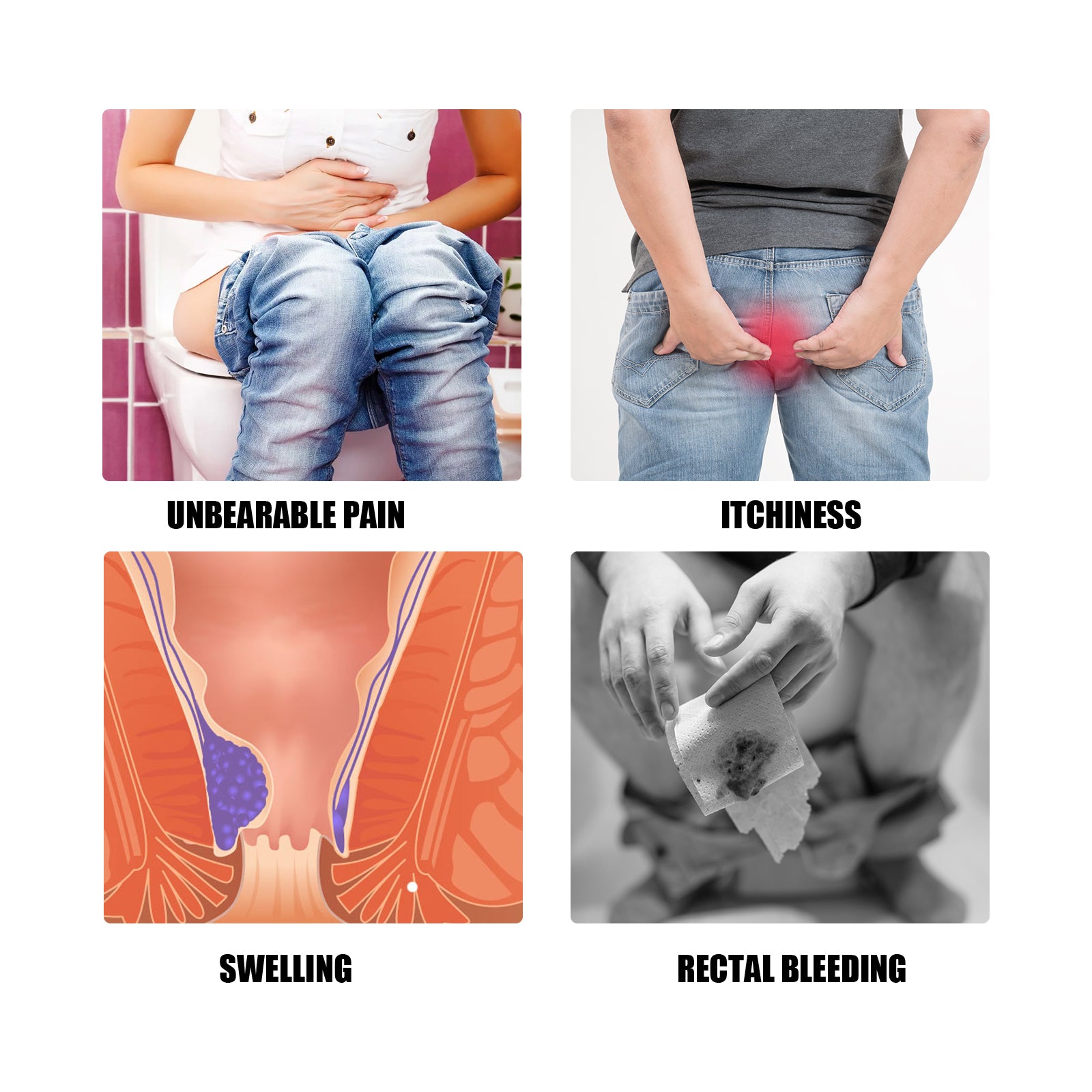 Four-panel grid showing unbearable pain, itchiness, swelling, and rectal bleeding symptoms with medical illustrations