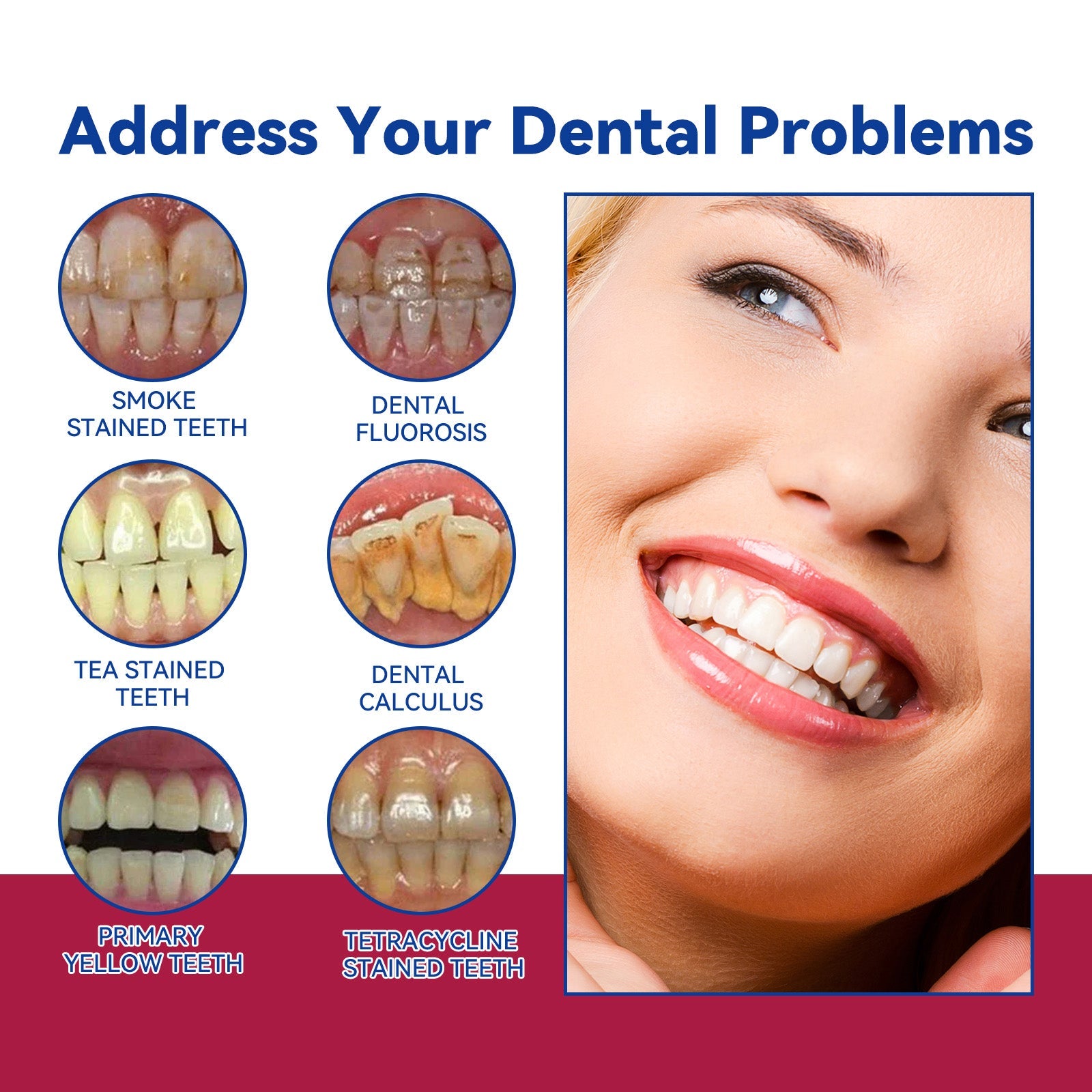 Grid showing six dental problems (smoke stains, fluorosis, tea stains, calculus, yellow teeth, tetracycline stains) with clinical photographs, plus close-up of healthy white smile result