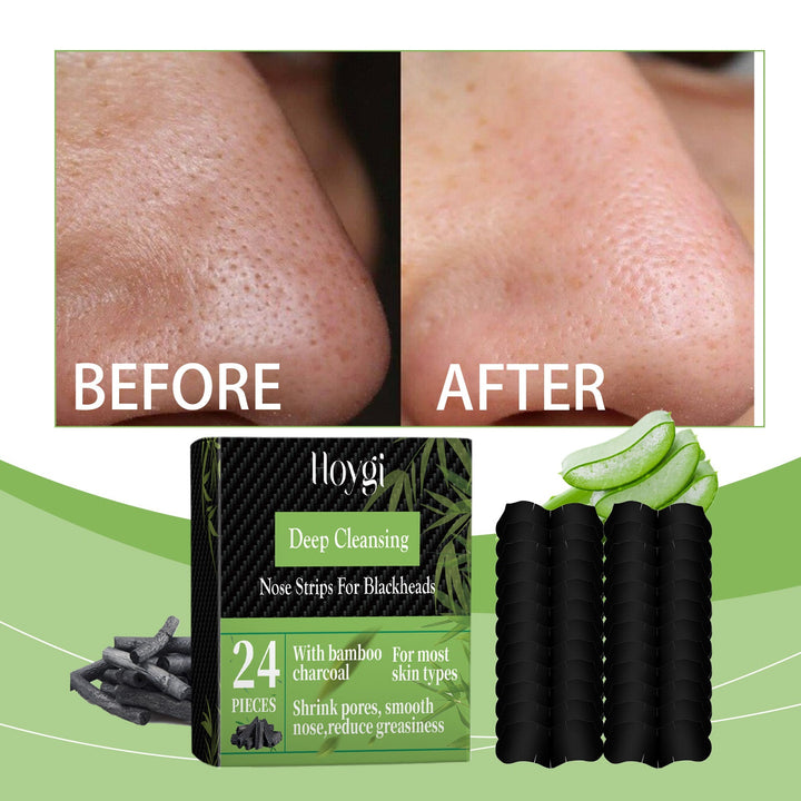 Bamboo Charcoal Nose Strips for Blackhead Removal