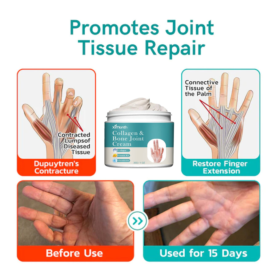 Joint Care Cream for Knee & Hand Pain – Fast Relief in 15 Days