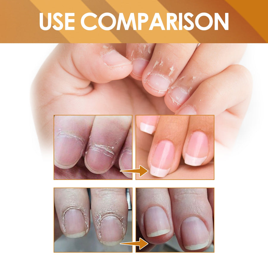 Cuticle Treatment Gel — Softer, Healthier Nails in 15 Seconds
