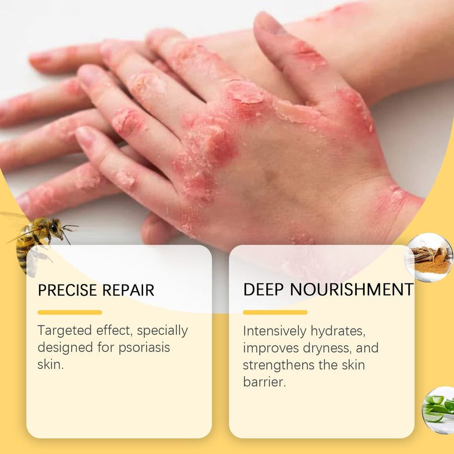 Psoriasis Moisturizing Cream for Dry, Itchy Skin