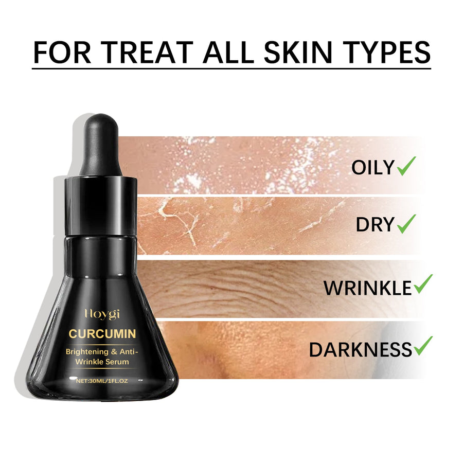 Curcumin Serum for Wrinkles, Dark Spots & Dull Skin
