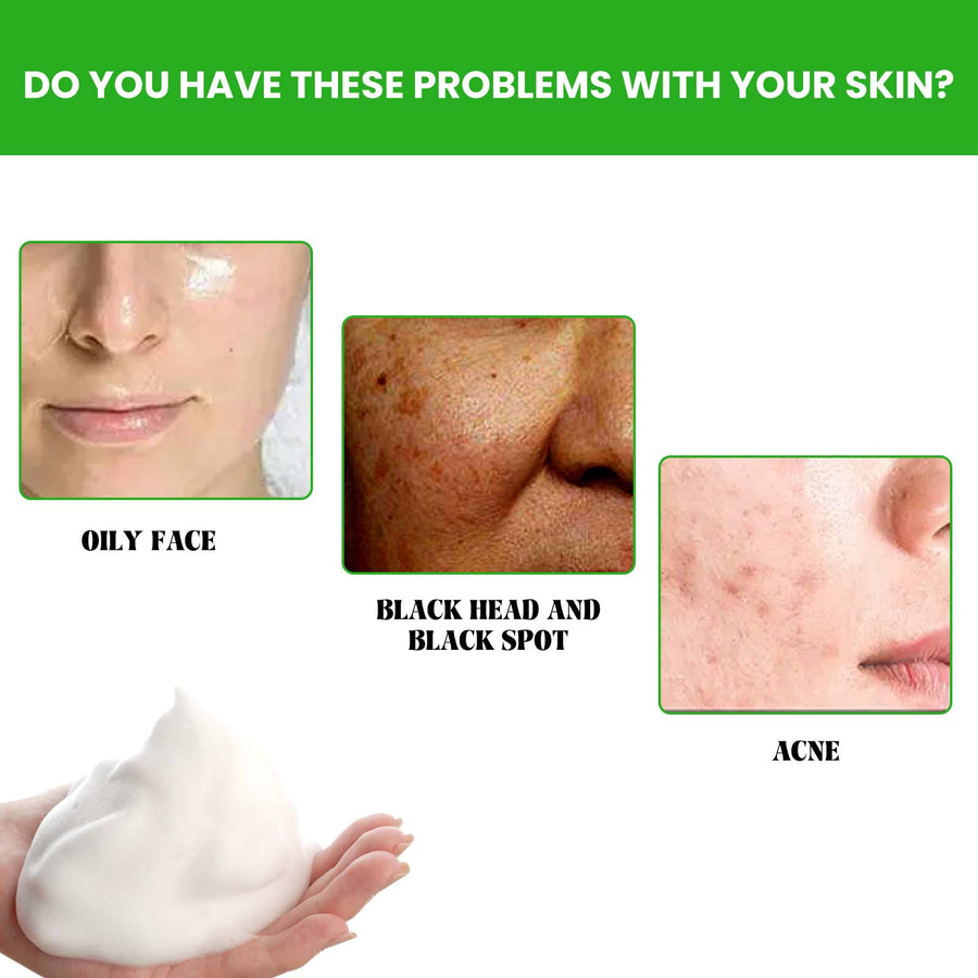 Anti Acne Facial Wash for Oily Skin & Blackheads