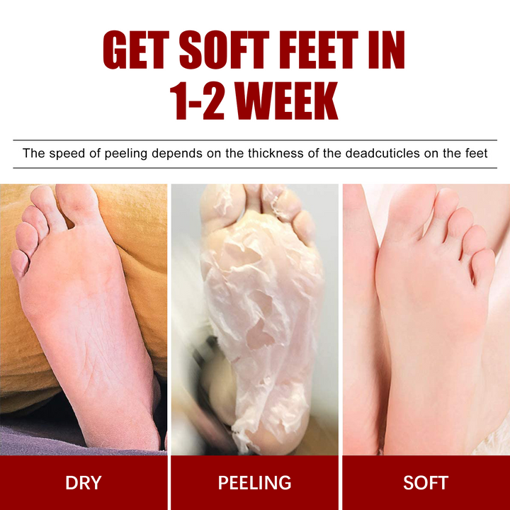Exfoliating Foot Peel Mask for Soft Smooth Feet Fast