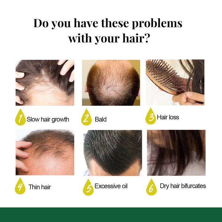 Ginger Hair Spray for Stronger, Healthier-Looking Hair