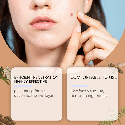 Bee Venom Skin Tag Serum for Smooth, Clear Skin