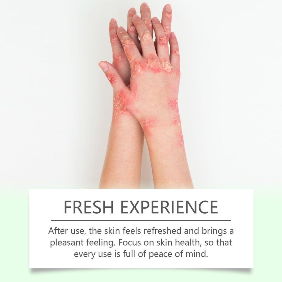 Herbal Skin Soothing Cream for Dry, Uncomfortable Skin
