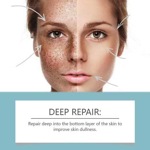 Nicotinamide Brightening Serum for Dark Spots & Uneven Tone