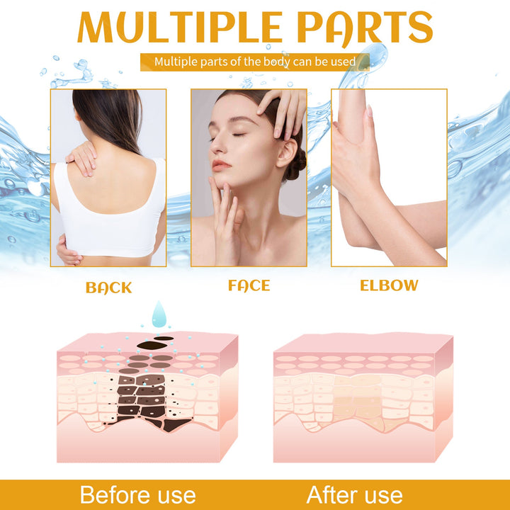 Spot Cleanser for Face & Body That Brightens Skin