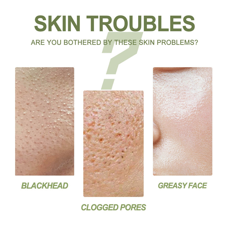Blackhead Removing Serum & Strip Kit for Clear Pores