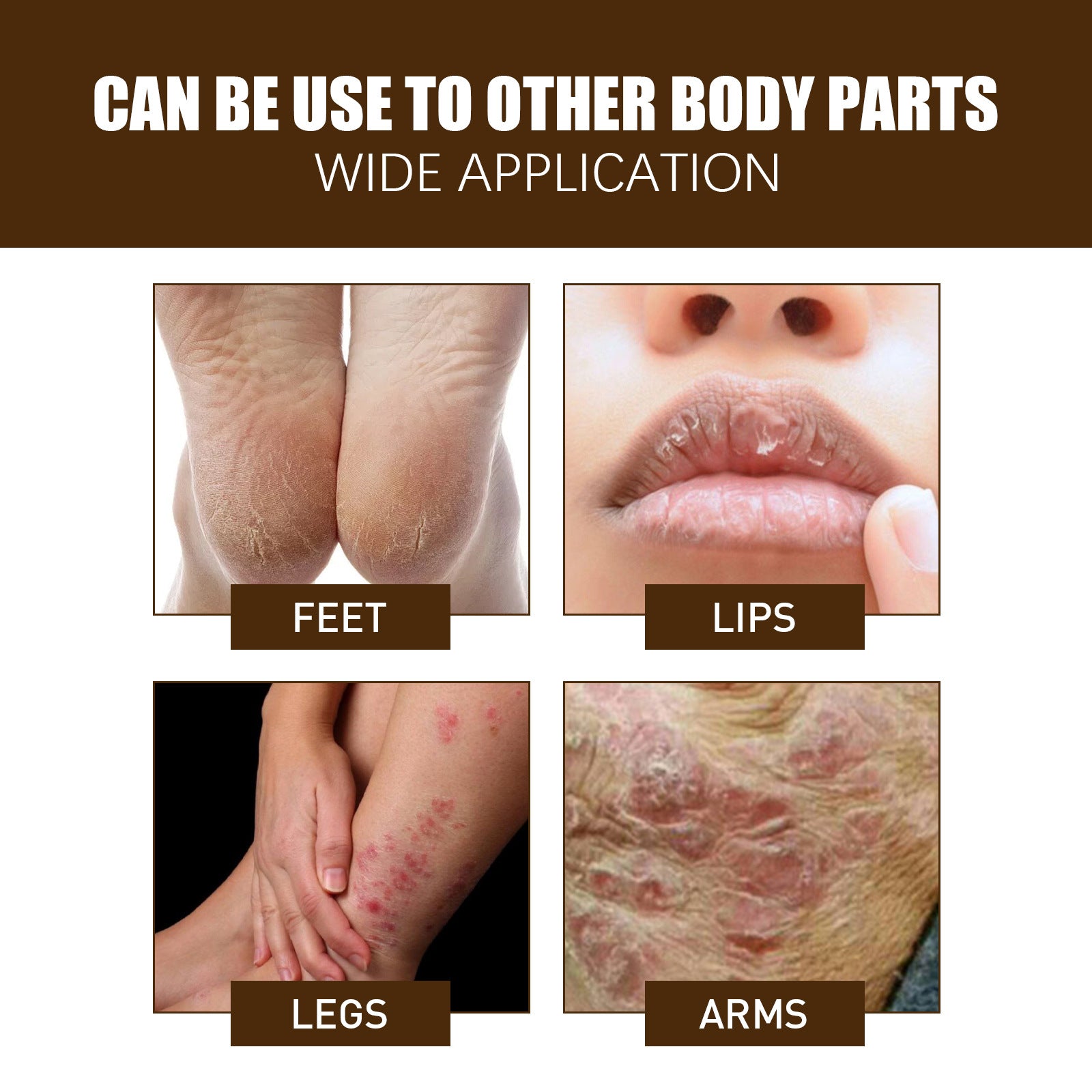 Multiple problem areas addressed: heel cleft palate with visible cracks, hand cracking, dry itching on neck, and peeling skin on palm. Certification badges for THC-free, cruelty-free, non-GMO, and 100% natural ingredients