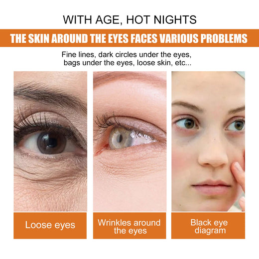 Turmeric Vitamin C Eye Cream for Fine Lines & Dark Circles