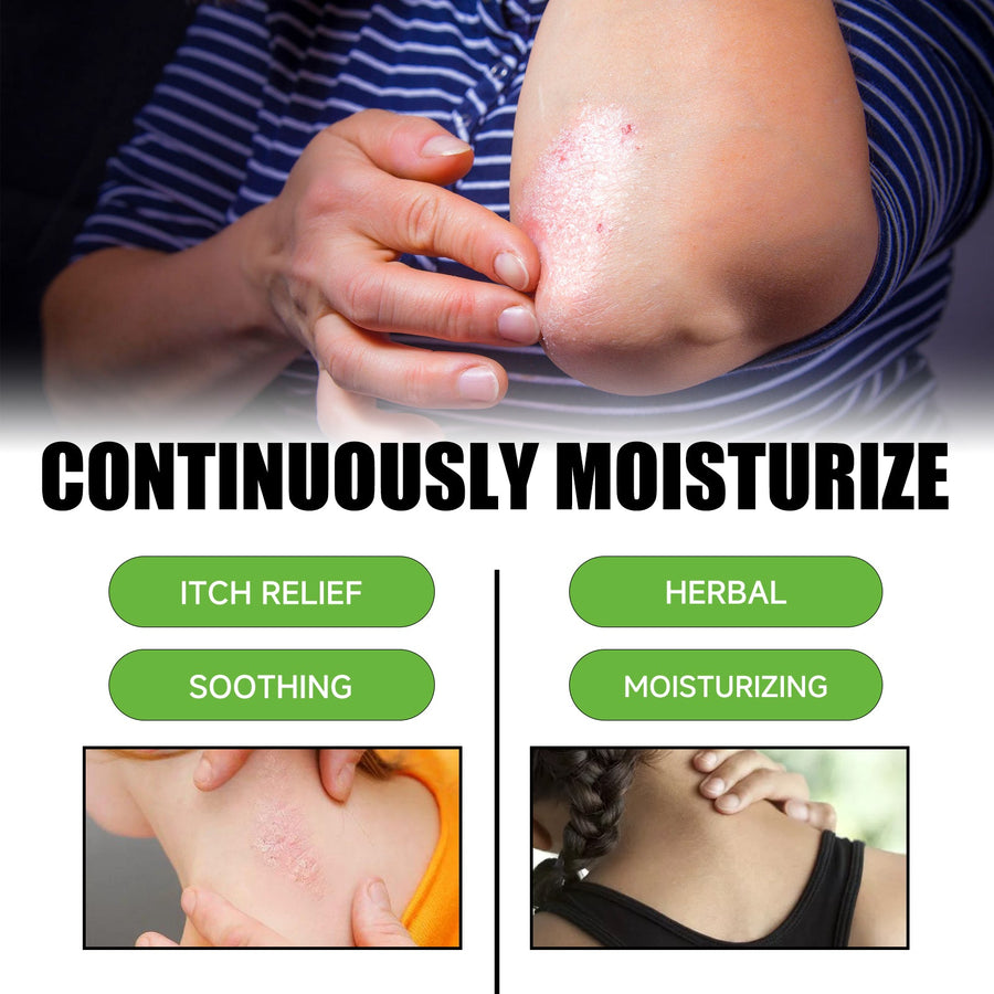 Psoriasis Cream for Itchy, Red, Irritated Skin Relief