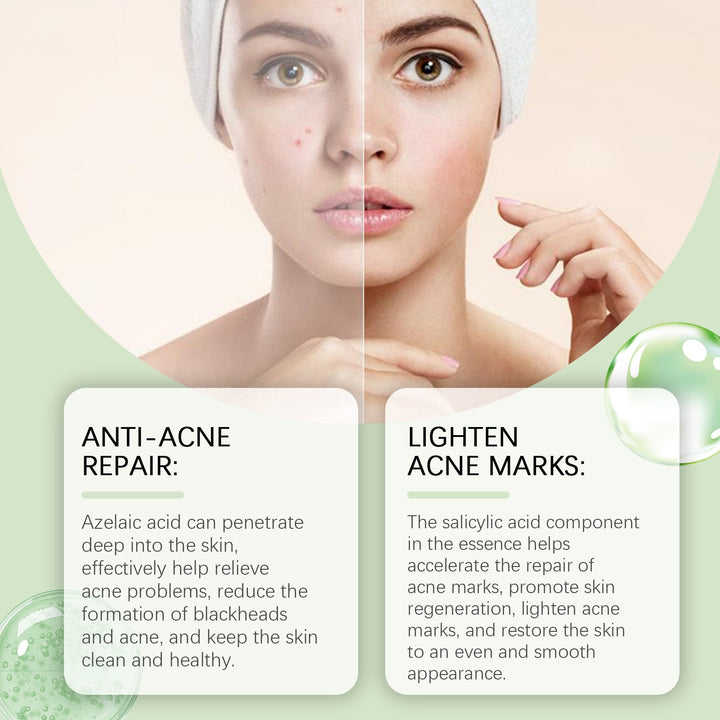 Azelaic Acid Essence for Blackheads, Pores & Acne Marks