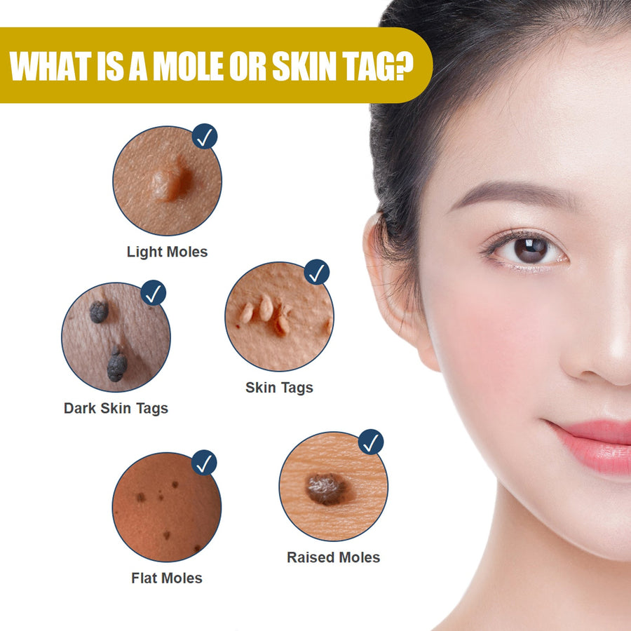 Skin Tag Remover Serum — Remove Moles & Warts Painlessly