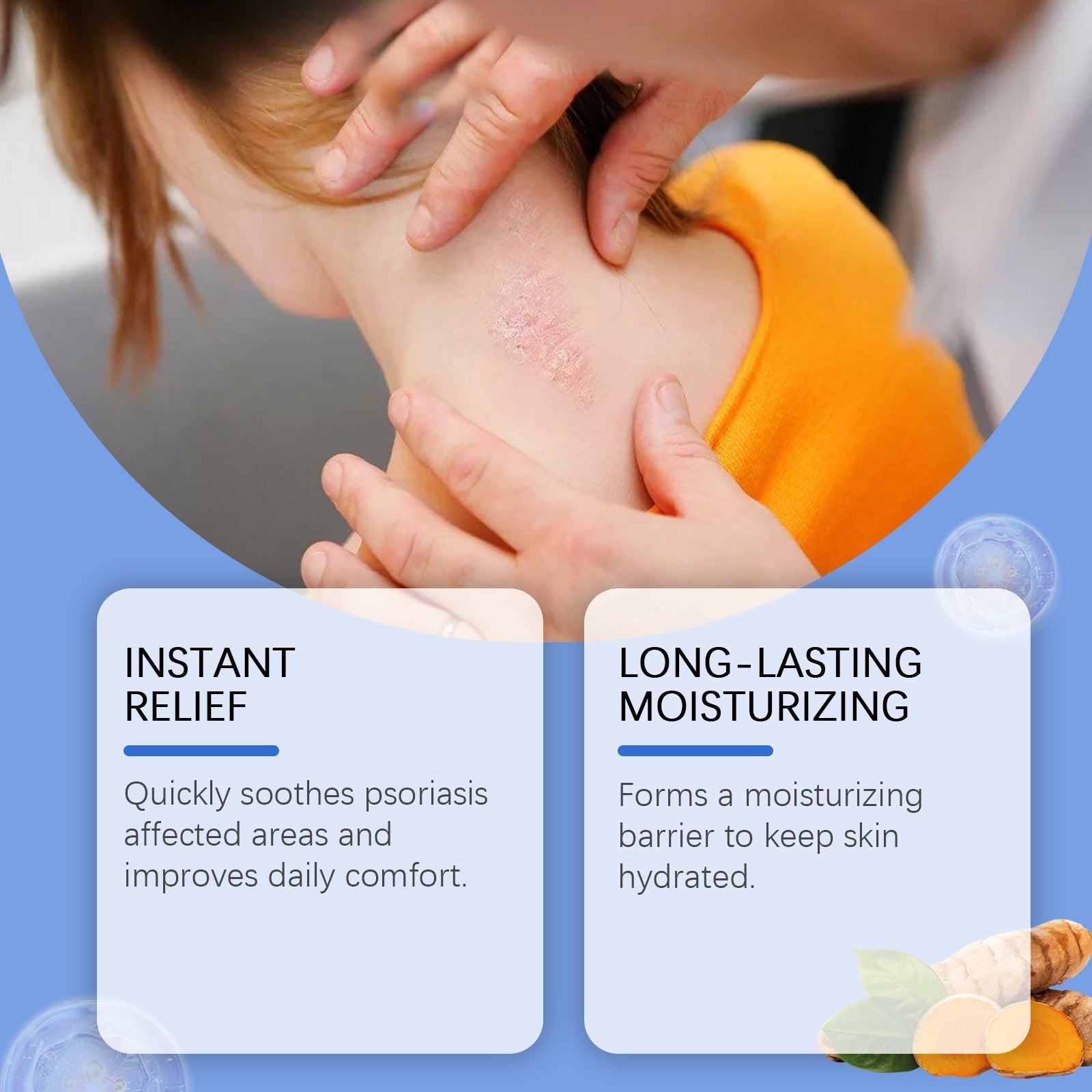 Child with visible psoriasis patch on neck with comparison cards showing Instant Relief and Long-Lasting Moisturizing benefits