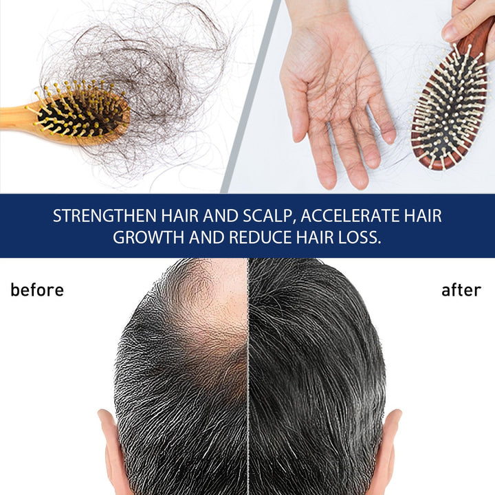 Hair Growth Cream for Thinning Hair & Scalp Support