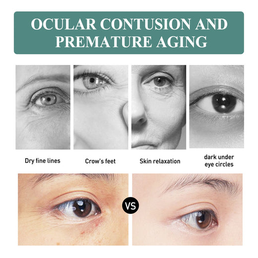 Anti-Wrinkle Eye Cream for Dark Circles & Fine Lines