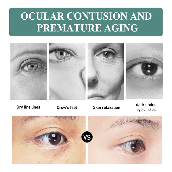 Anti-Wrinkle Eye Cream for Dark Circles & Fine Lines