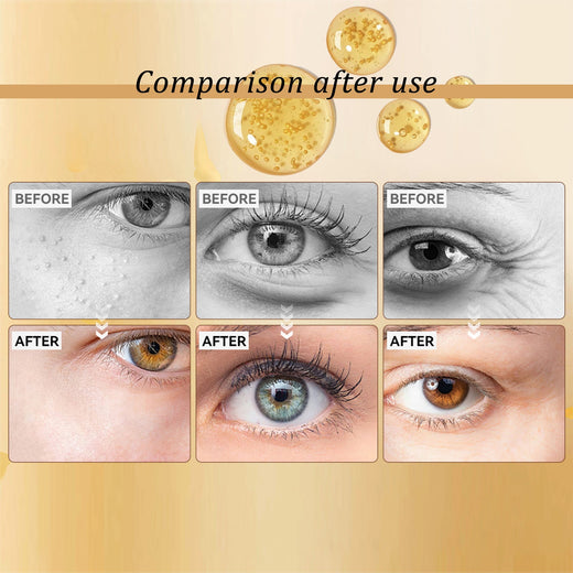 Snail Peptide Eye Cream – Reduce Puffiness & Fine Lines