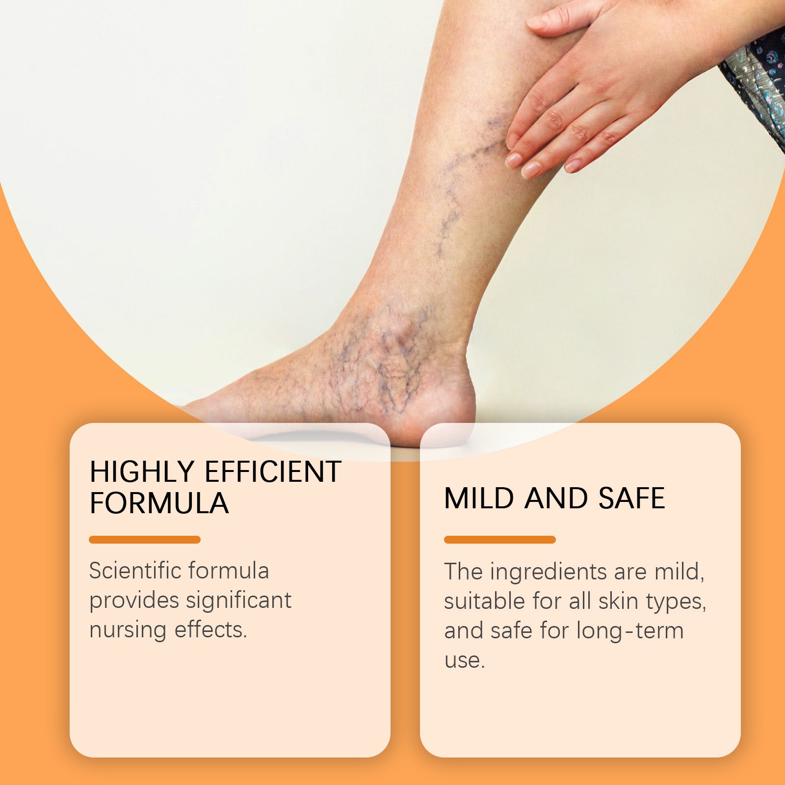 Visible varicose veins on leg with patch application, showing clinical effectiveness