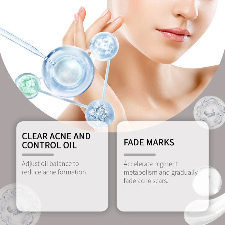 Acne Care Set for Clearer, Brighter-Looking Skin Daily