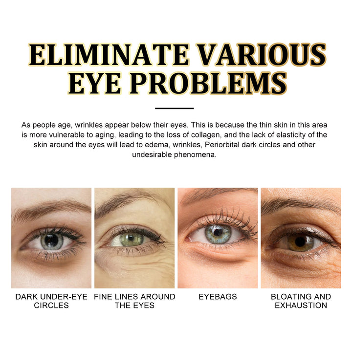 Gold Snail Collagen Eye Masks for Puffy, Tired Eyes