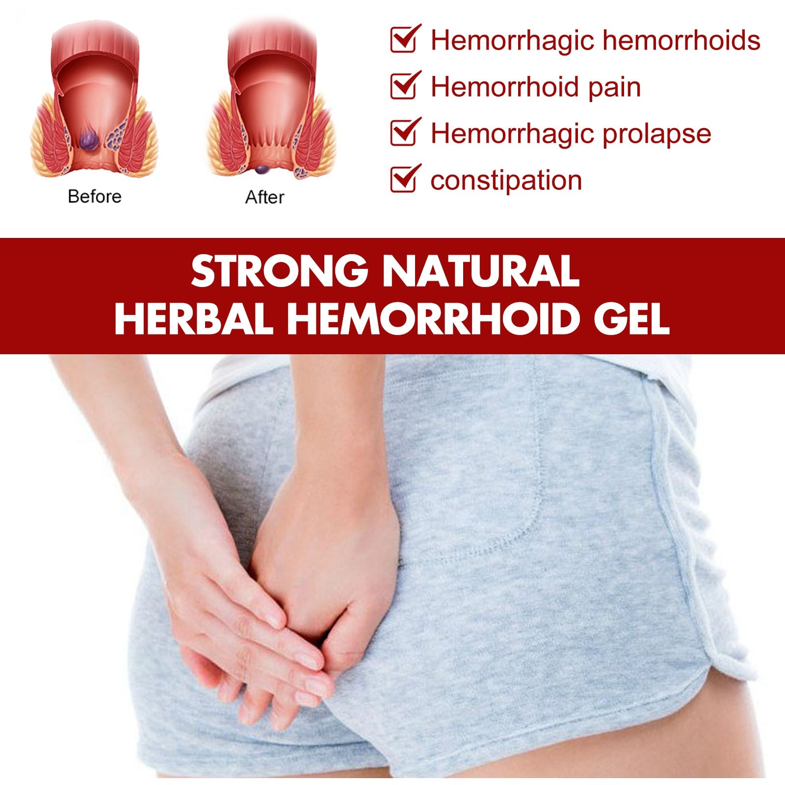 Medical anatomical before/after comparison of hemorrhoid severity with symptom checklist (hemorrhagic hemorrhoids, hemorrhoid pain, hemorrhagic prolapse, constipation)
