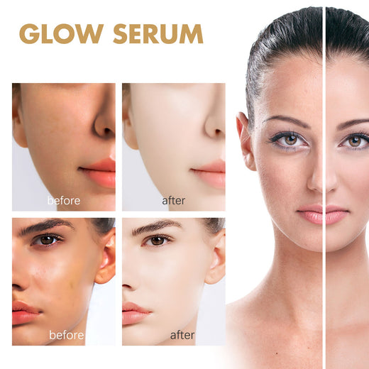 Propolis Niacinamide Brightening Serum — Fade Acne Marks