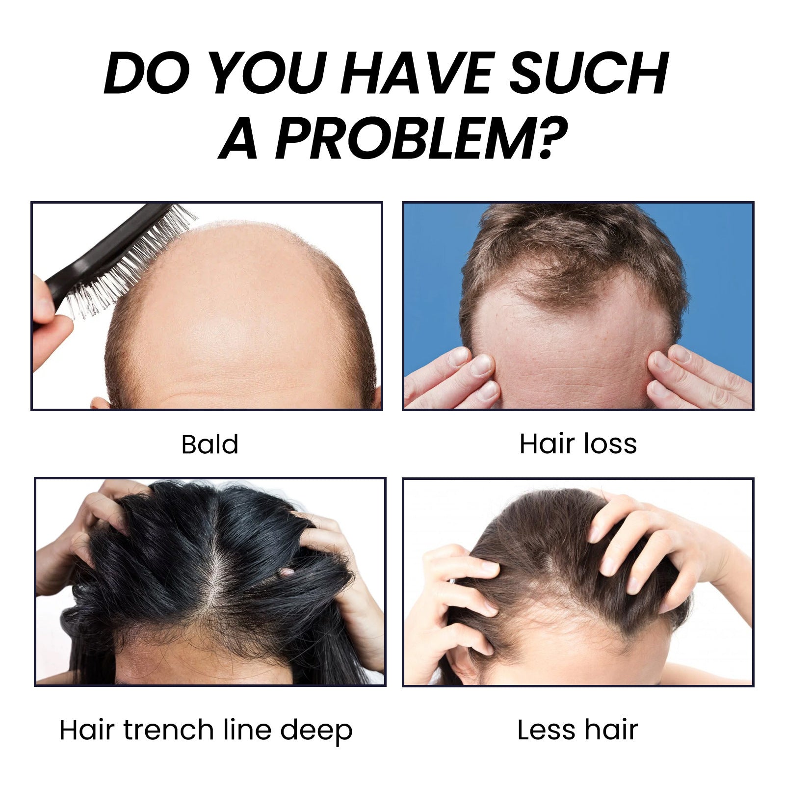 Problem statement graphic showing four hair loss scenarios: baldness, hair loss, hair trench line deep, and less hair density