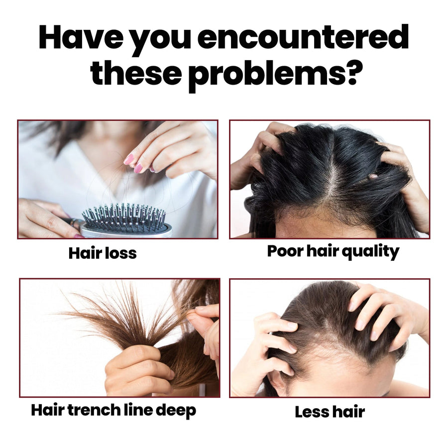 Hair Growth Serum – Fast-Acting 98% Herbal, Restores Thickness