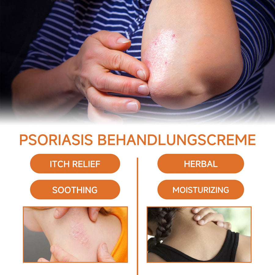 Psoriasis Cream with Bee Venom – Soothes Itch & Repairs Skin