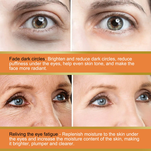 Vitamin C Eye Balm Stick for Dark Circles & Puffiness
