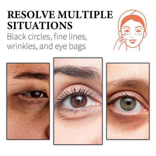 Retinol Collagen Eye Cream for Dark Circles & Bags