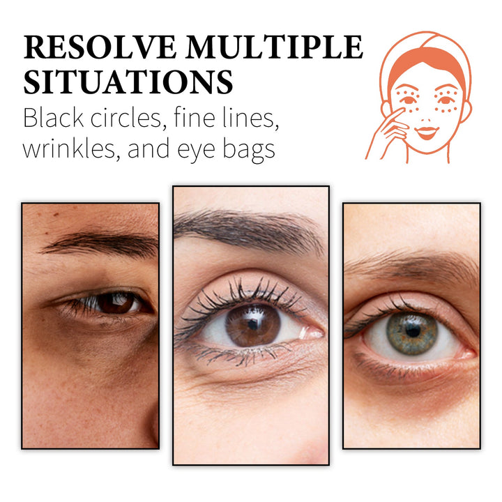 Retinol Collagen Eye Cream for Dark Circles & Bags