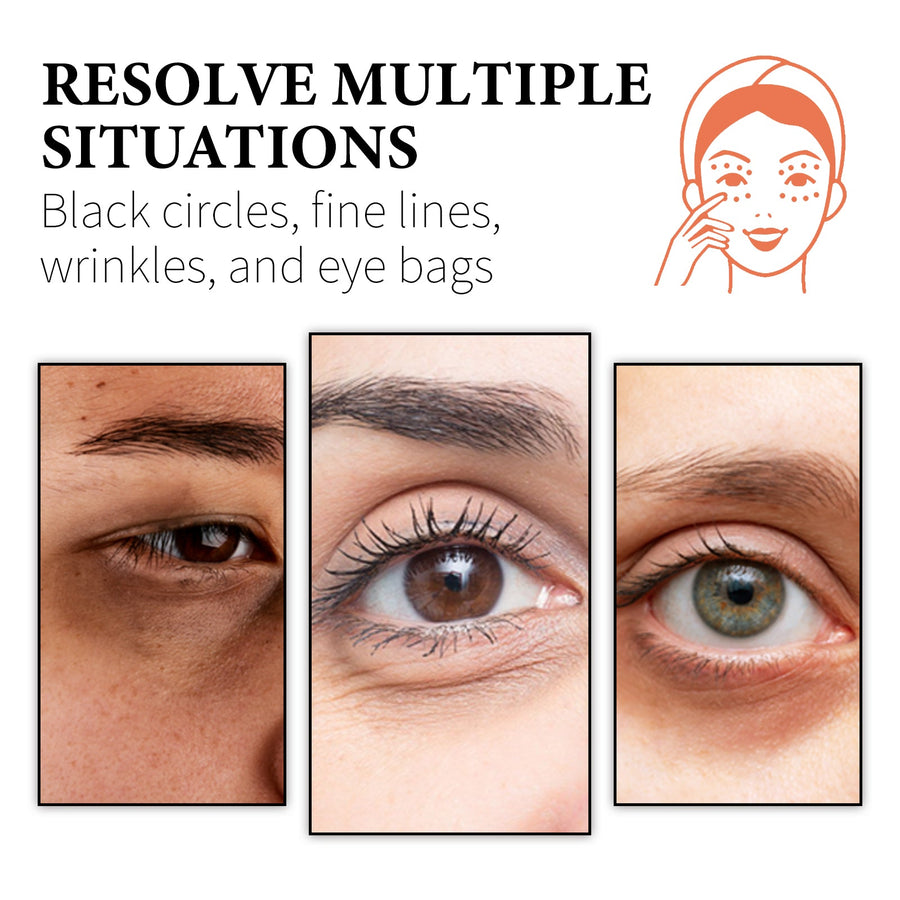 Retinol Collagen Eye Cream for Dark Circles & Bags