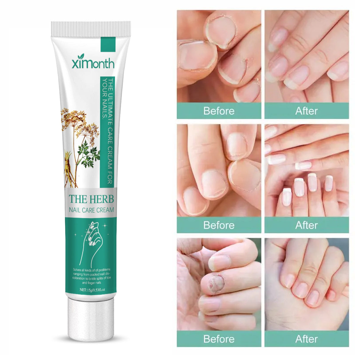 Nail Repair Cream for Grey, Brittle & Thickened Nails