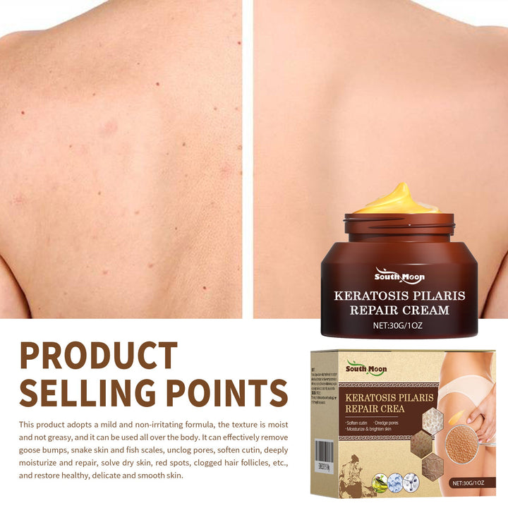 Body Cream for Keratosis Pilaris & Bumpy Skin Texture