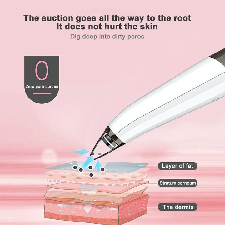 Professional Blackhead Vacuum — 6 Heads & 3 Modes