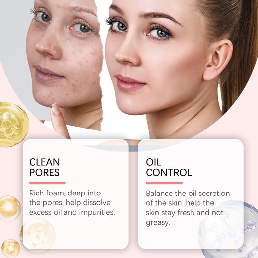 Salicylic Acid Foam Cleanser for Gentle Oil Control