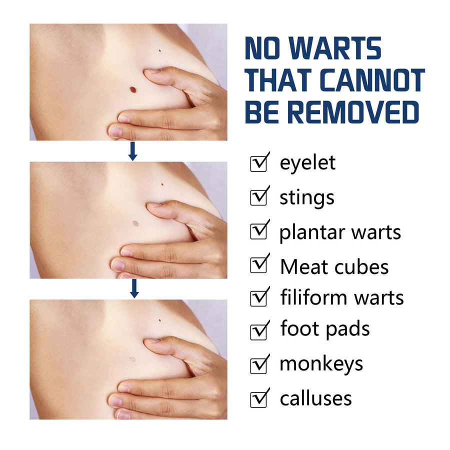 Wart Repair Kit for At-Home Spot Treatment Care