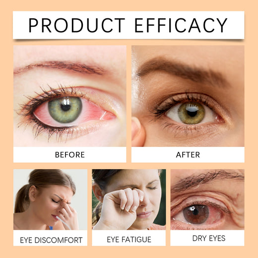Jimerito Honey Eye Drops for Dry, Tired Eyes Relief