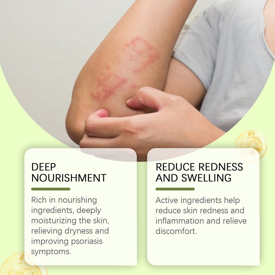 Bee Venom Cream for Psoriasis Redness & Dry Skin Relief