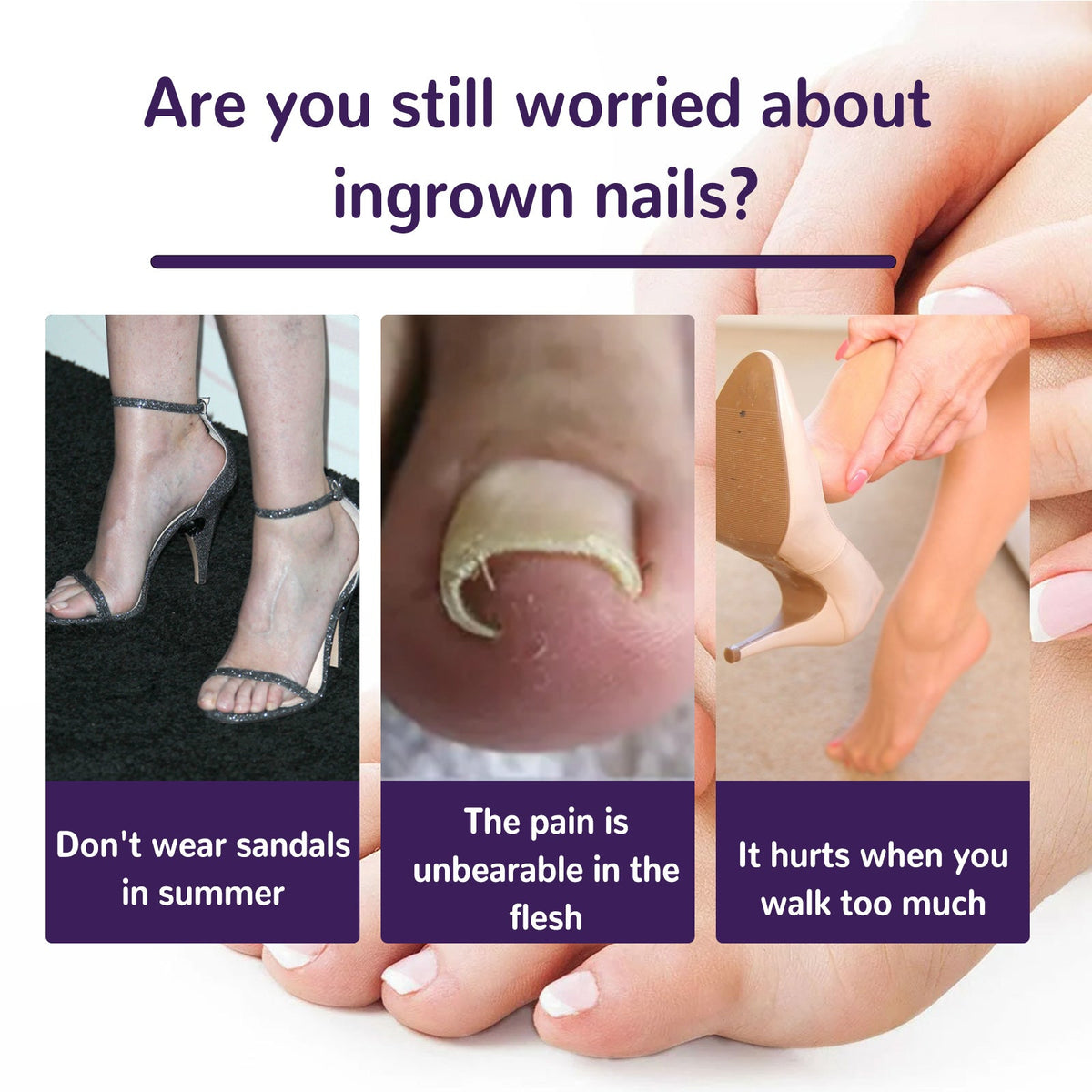 Elastic Toenail Correction Patch for Ingrown Nail Relief