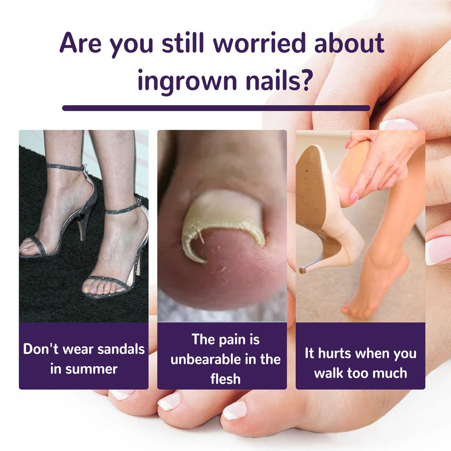 Elastic Toenail Correction Patch for Ingrown Nail Relief