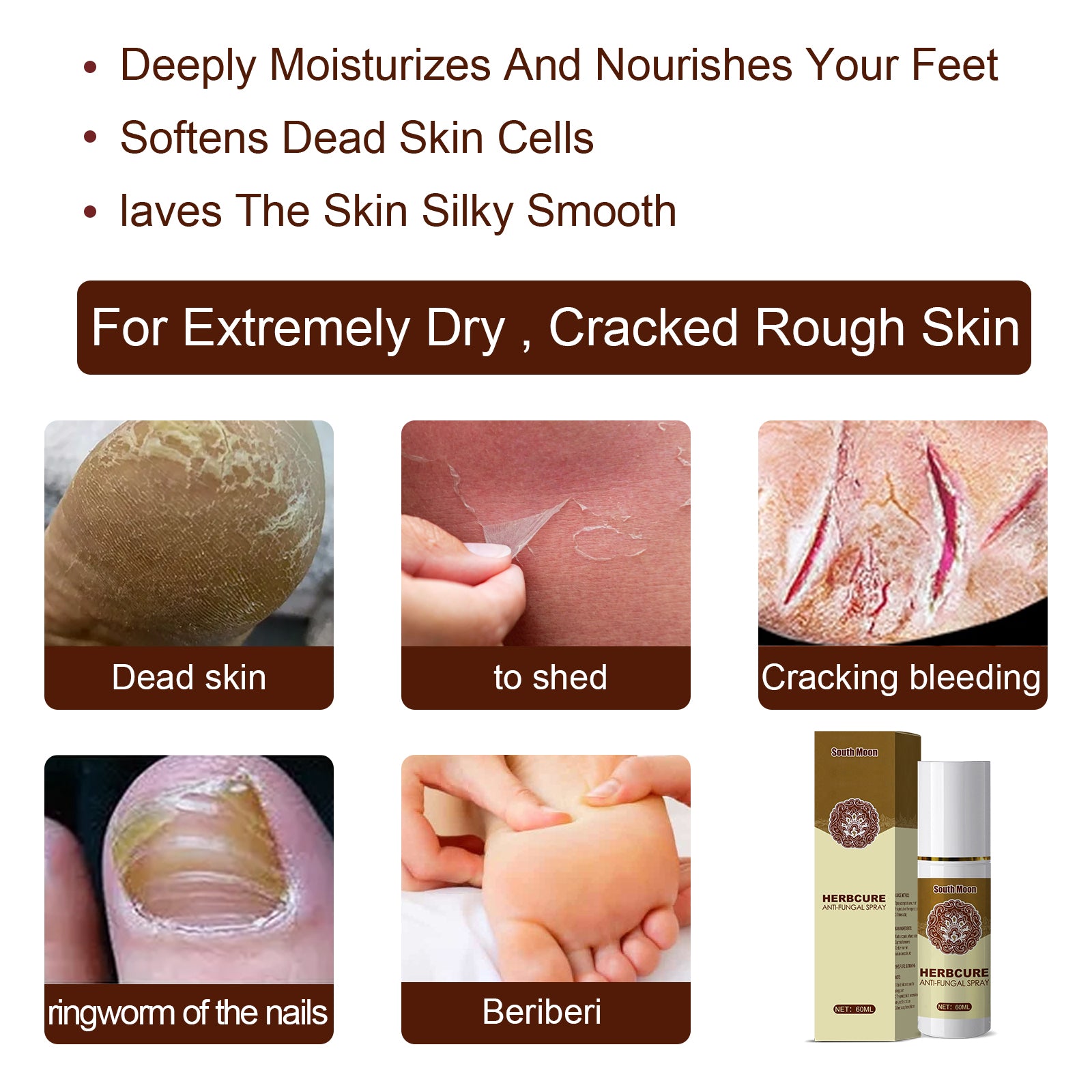 Composite image showing feet of multiple people with various fungal conditions (discolored, cracked, infected) transitioning to clear healthy skin, plus magnified close-up detail of improvement