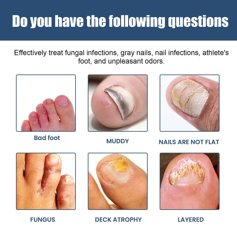 Gray Nail Foot Spray – Gentle Plant‑Based Nail Care